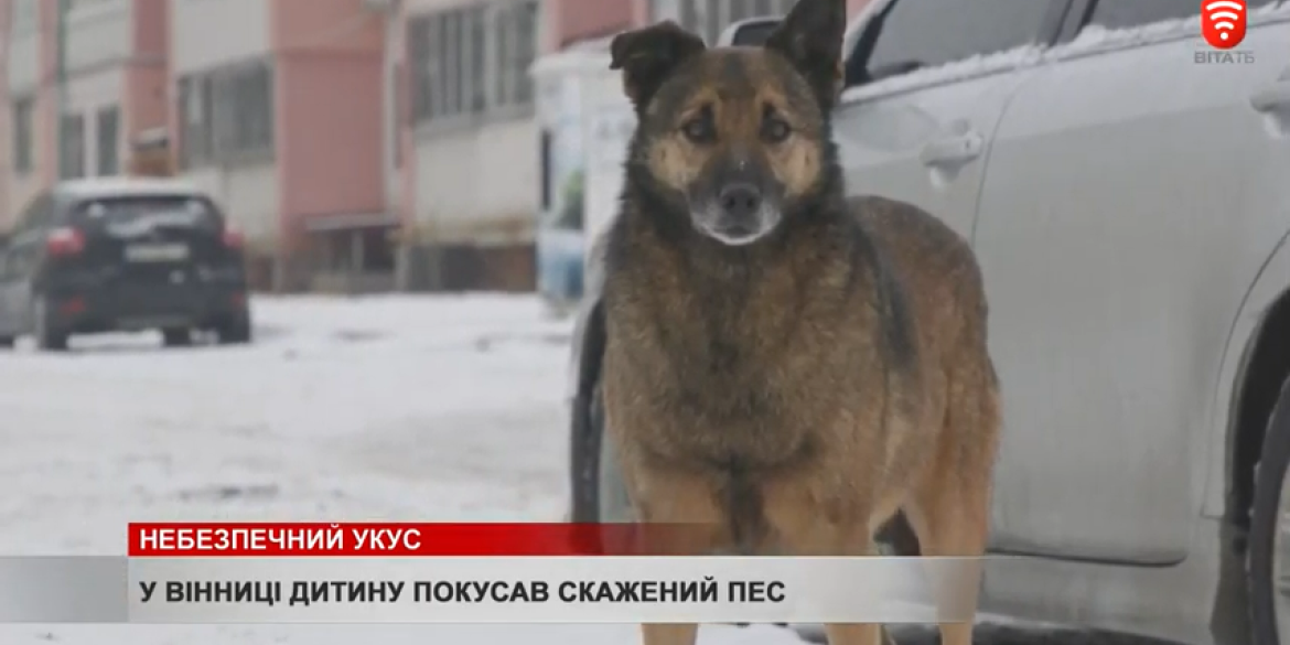 У Вінниці дитину покусав скажений пес