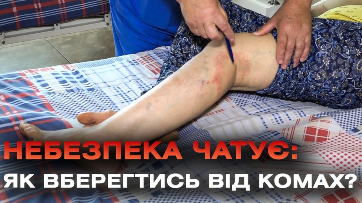 Embedded thumbnail for Які перші симптоми укусу комахи і яких дій варто дотримуватись, аби не нашкодити власному здоров’ю