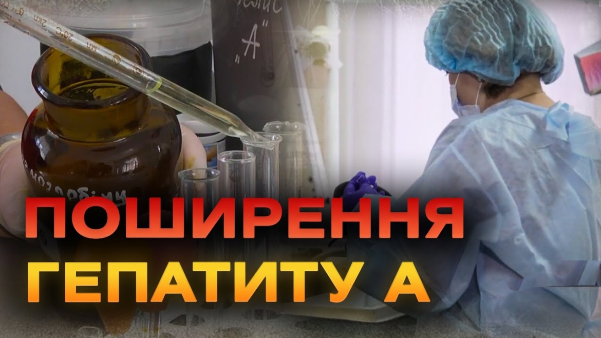 Embedded thumbnail for У Вінниці профільні спеціалісти відповіли на запитання про спалах гепатиту А