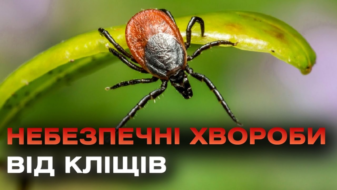 Embedded thumbnail for Які небезпечні хвороби переносять кліщі та яка профілактика? Симптоми та наслідки хвороби Лайма