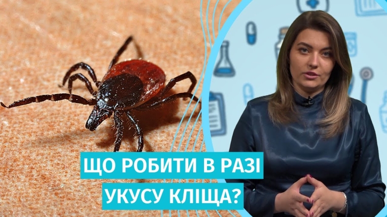 Embedded thumbnail for Сезон кліщів розпочався: як вберегтися