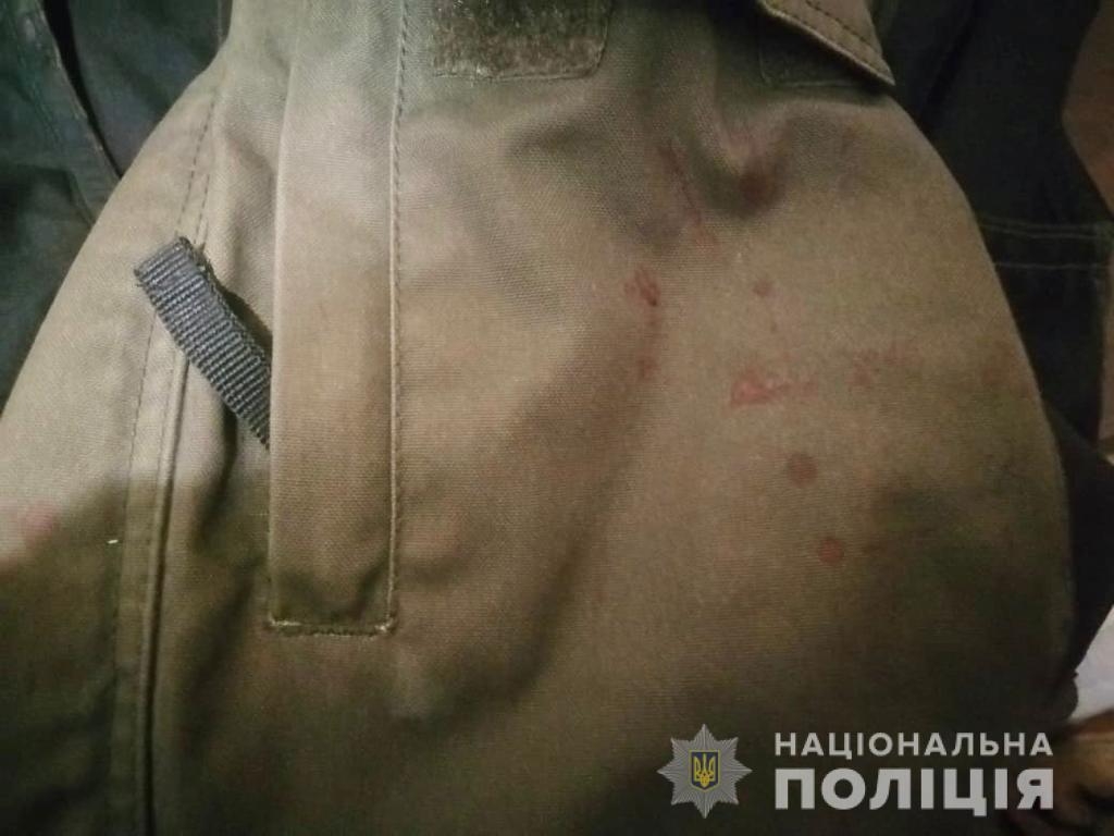 У Козятині затримали чоловіка, який побив та пограбував перехожого